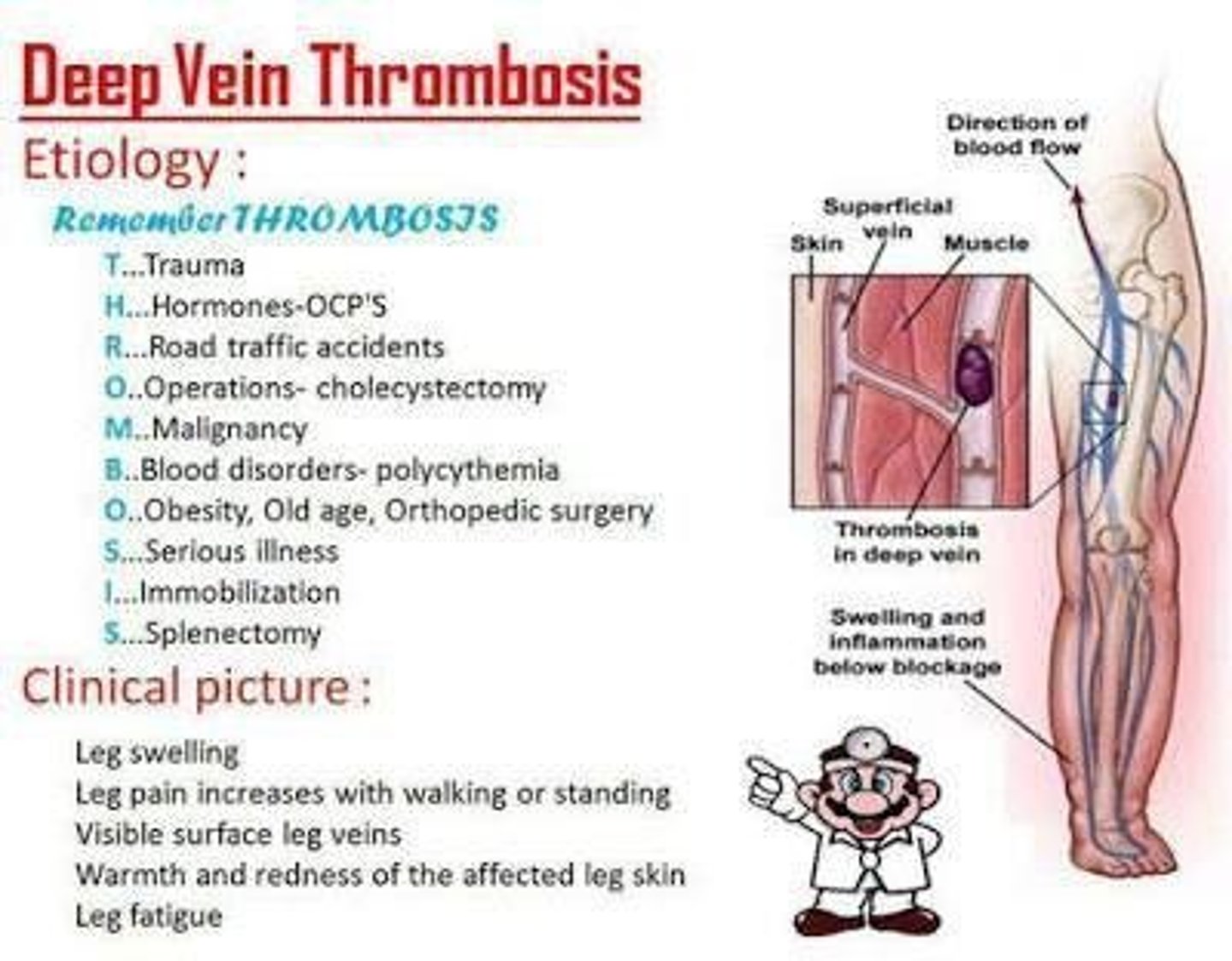 <p>A blood clot in a large vein, most commonly in the lower leg.</p>