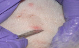 <p>Scraping of cells from a lesion done with the edge of a scalpel; cells are examined under a microscope to diagnose tinea.</p>