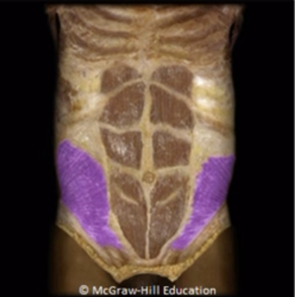 <p>Internal abdominal oblique</p>