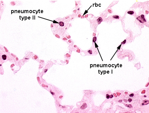 <p>Alveoli</p>