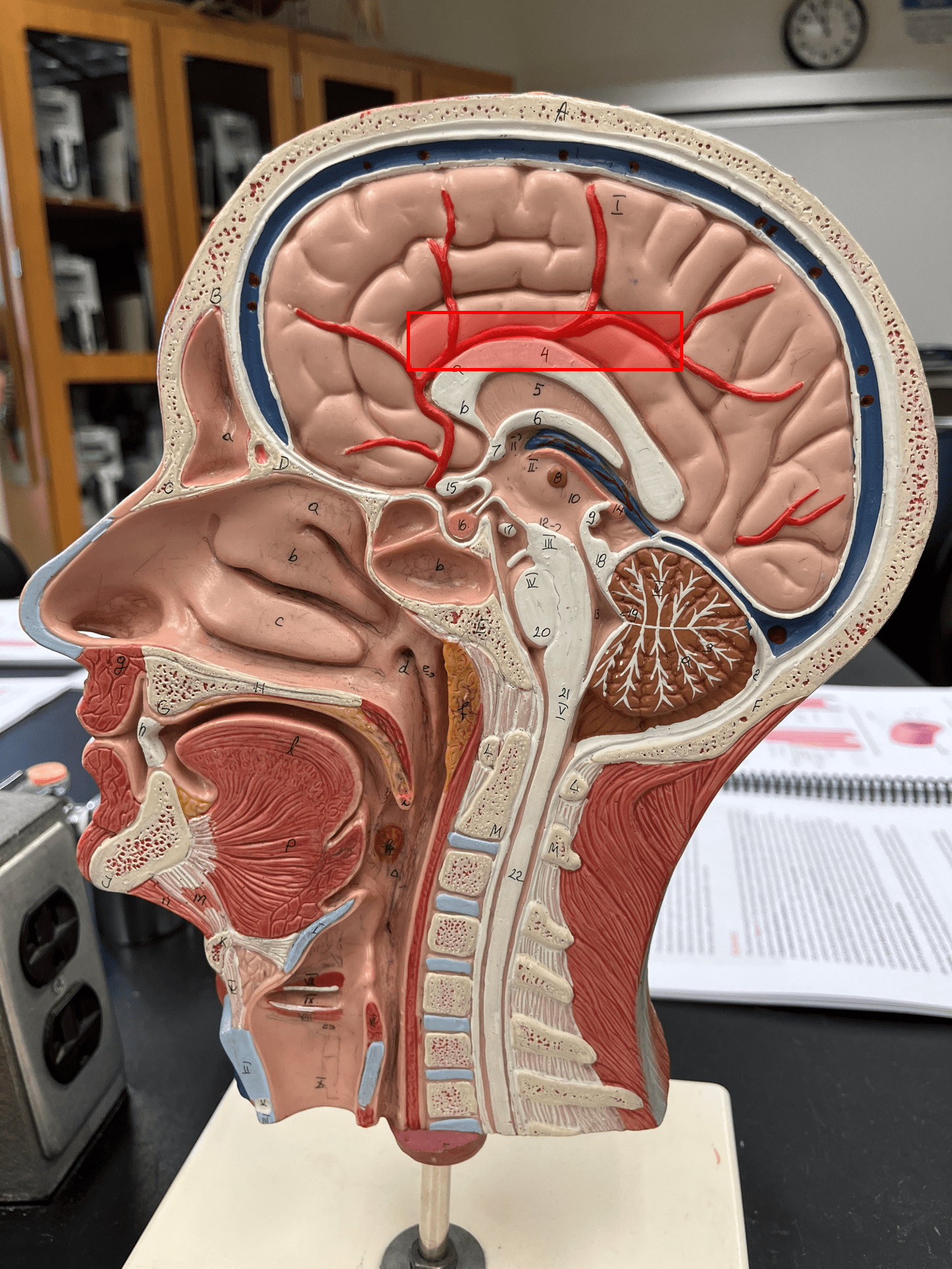<p>• An artery of the cerebral circulation.</p>
<p>• Originates from the internal carotid artery.</p>
<p>• Supplies the frontal and parietal lobes of the brain.</p>