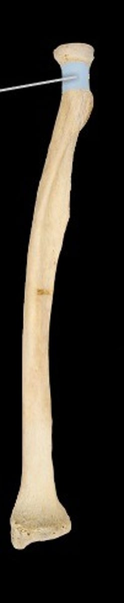 <p>Narrow region below the radial head.</p>
