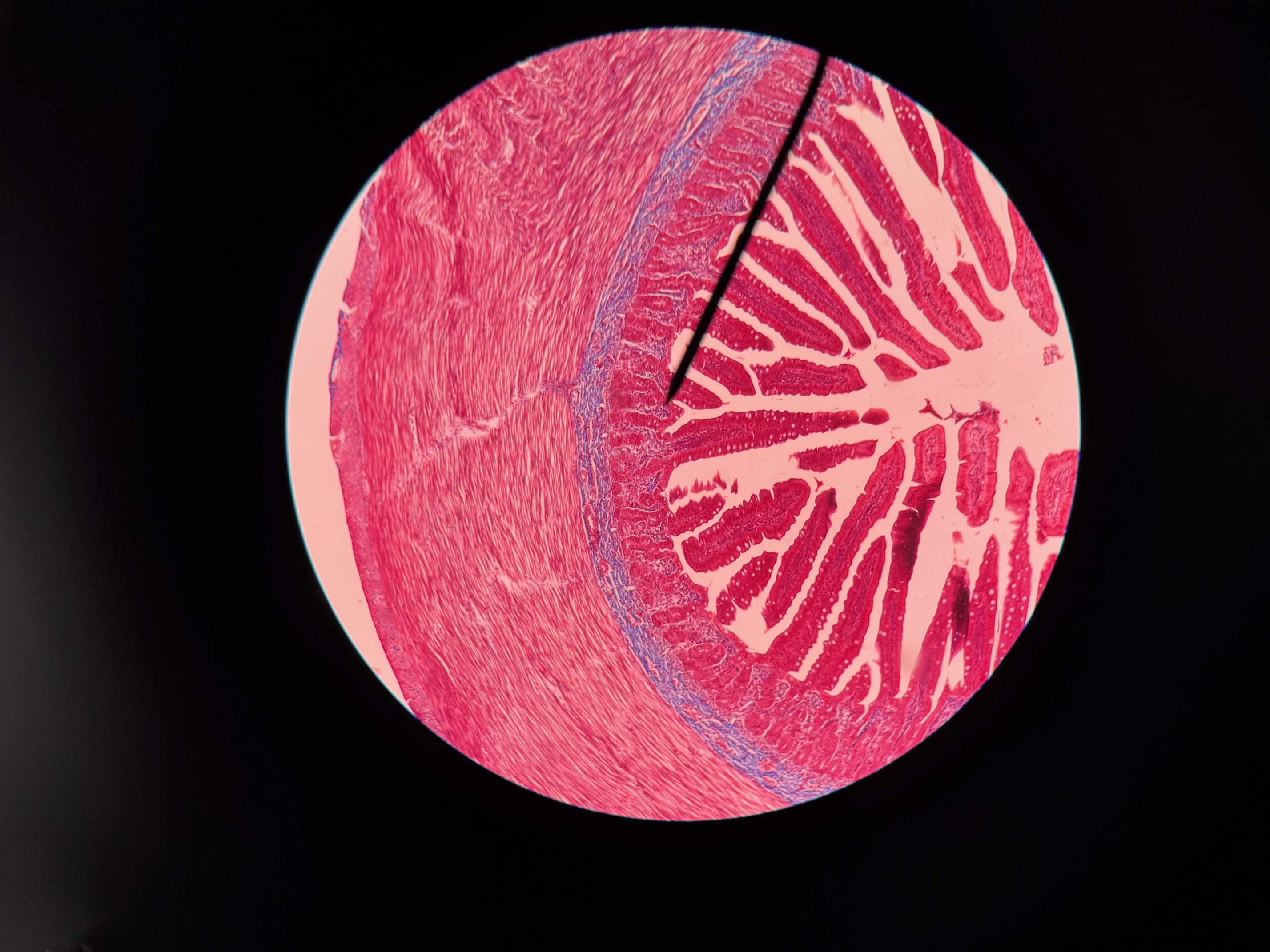 <p>Organ?</p><p>Region?</p>