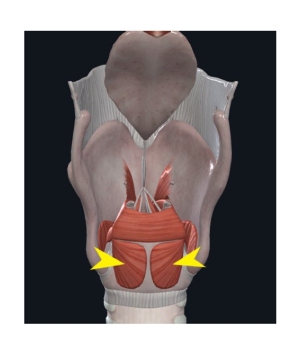 <p>What is this muscle?</p>