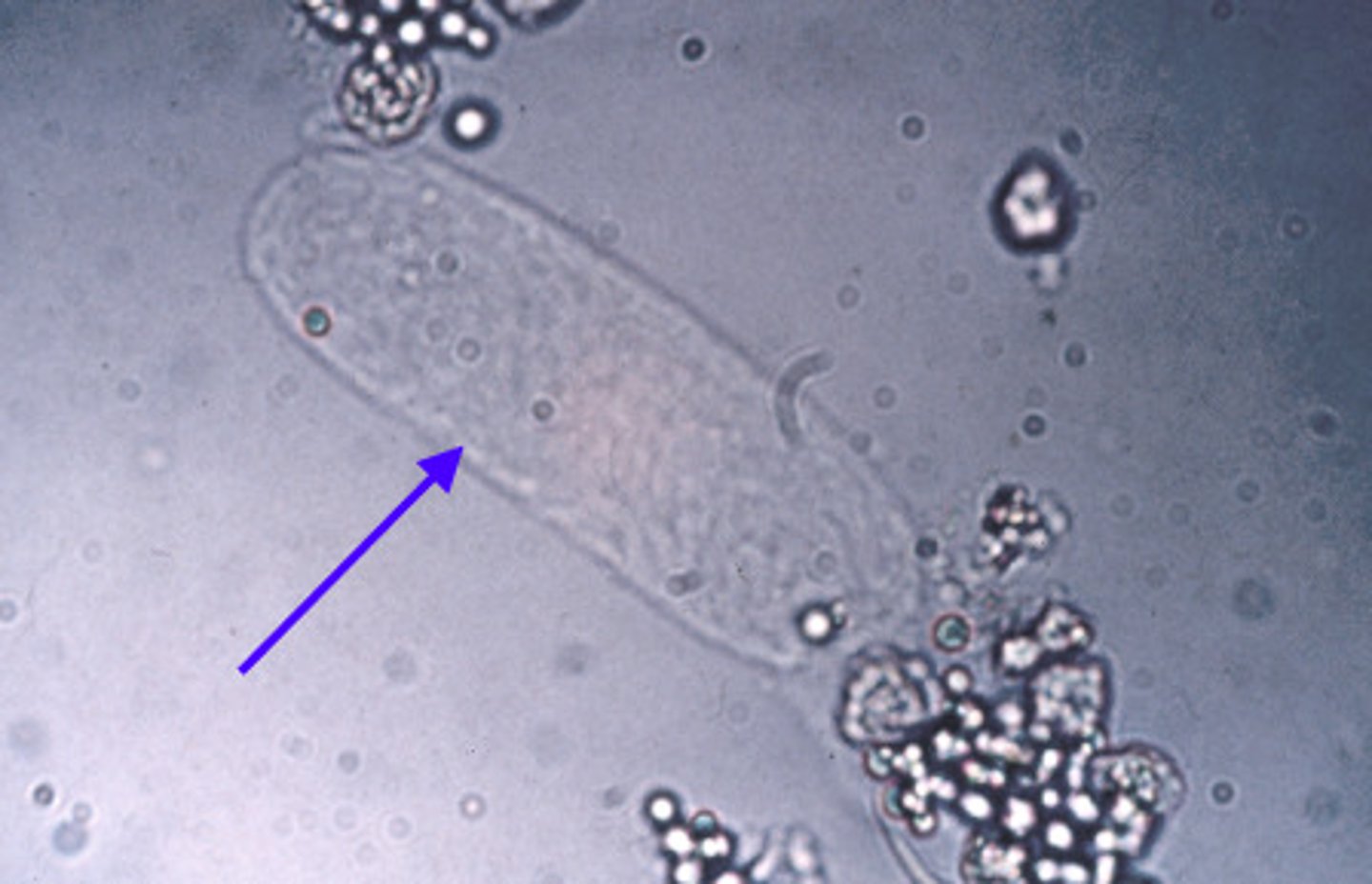 <p>consist of only the uromodulin protein matrix (0-2/low power field) are normal. They may be visible in the urine sediment if the individual has been exercising heavily, has a fever, or is undergoing diuretic therapy.</p>