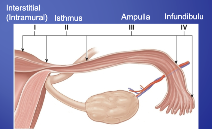 <ul><li><p>Interstitial (Intramural)</p></li><li><p>Isthmus</p></li><li><p>Ampulla</p></li><li><p>Infundibulum</p></li></ul><p></p>