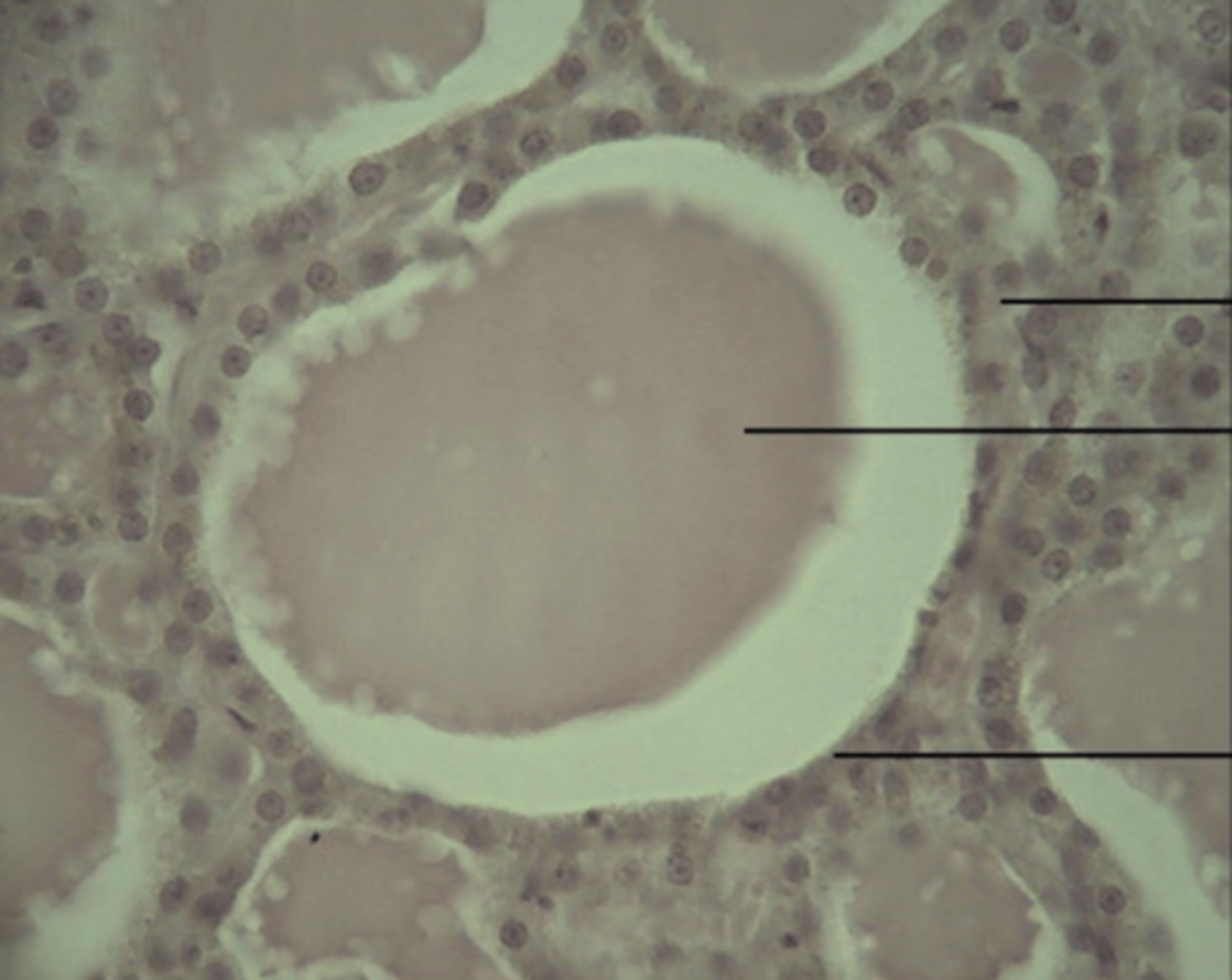 <p>gland</p>