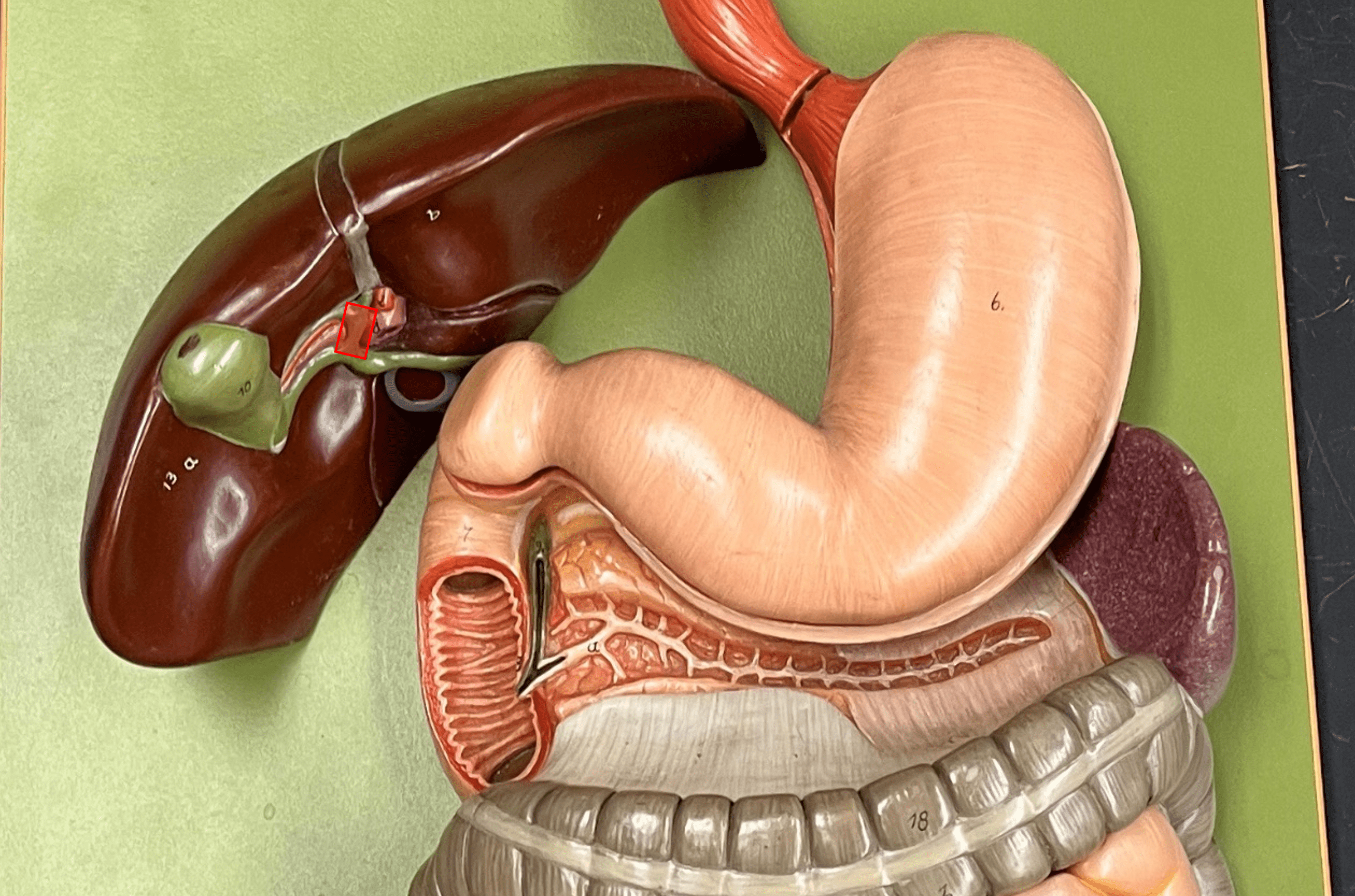 • A bile duct.

• The convergence of the R. and L. hepatic ducts.

• Converges with the cystic duct to form the common bile duct.