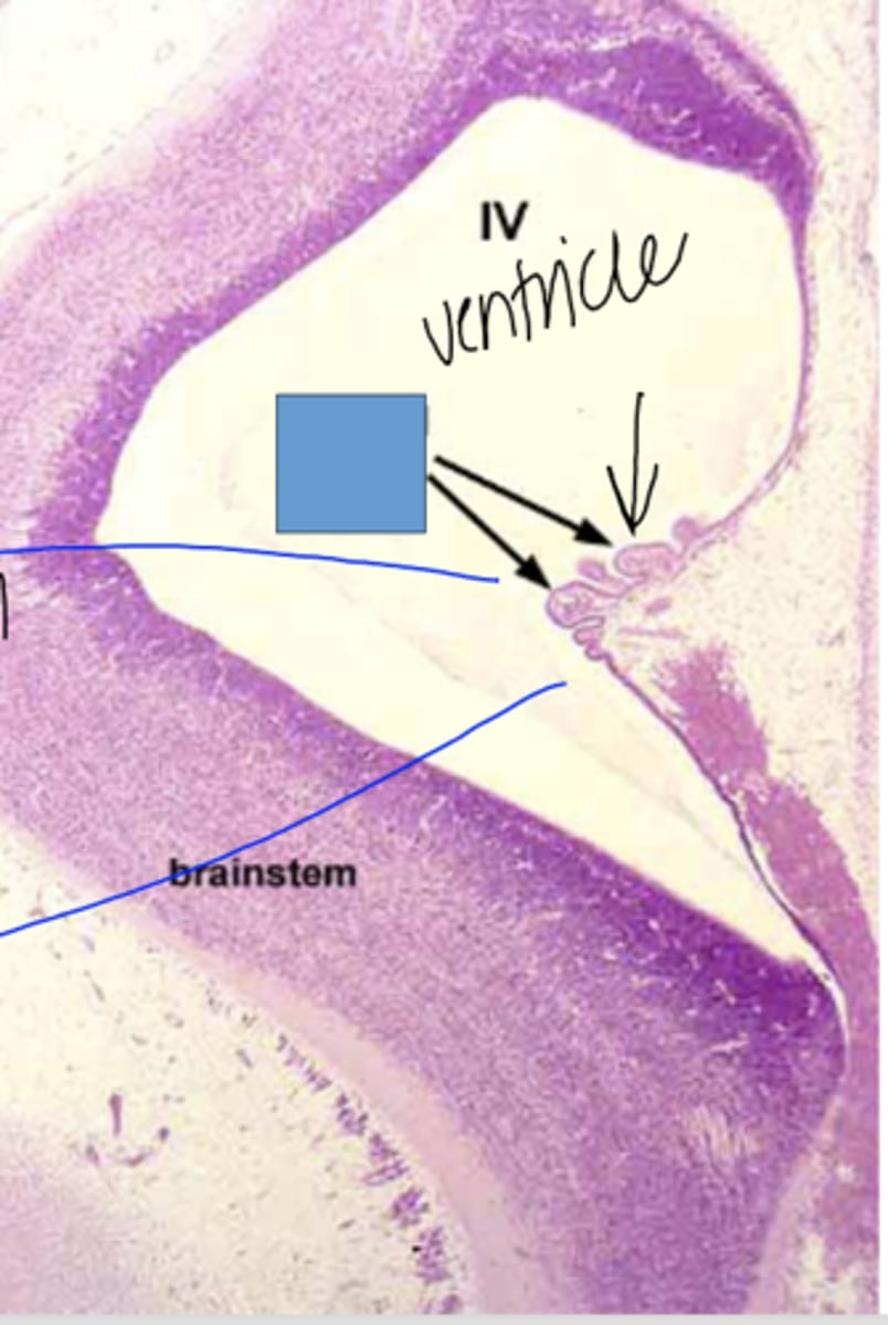 <p>Identify the following structure of the PNS</p>