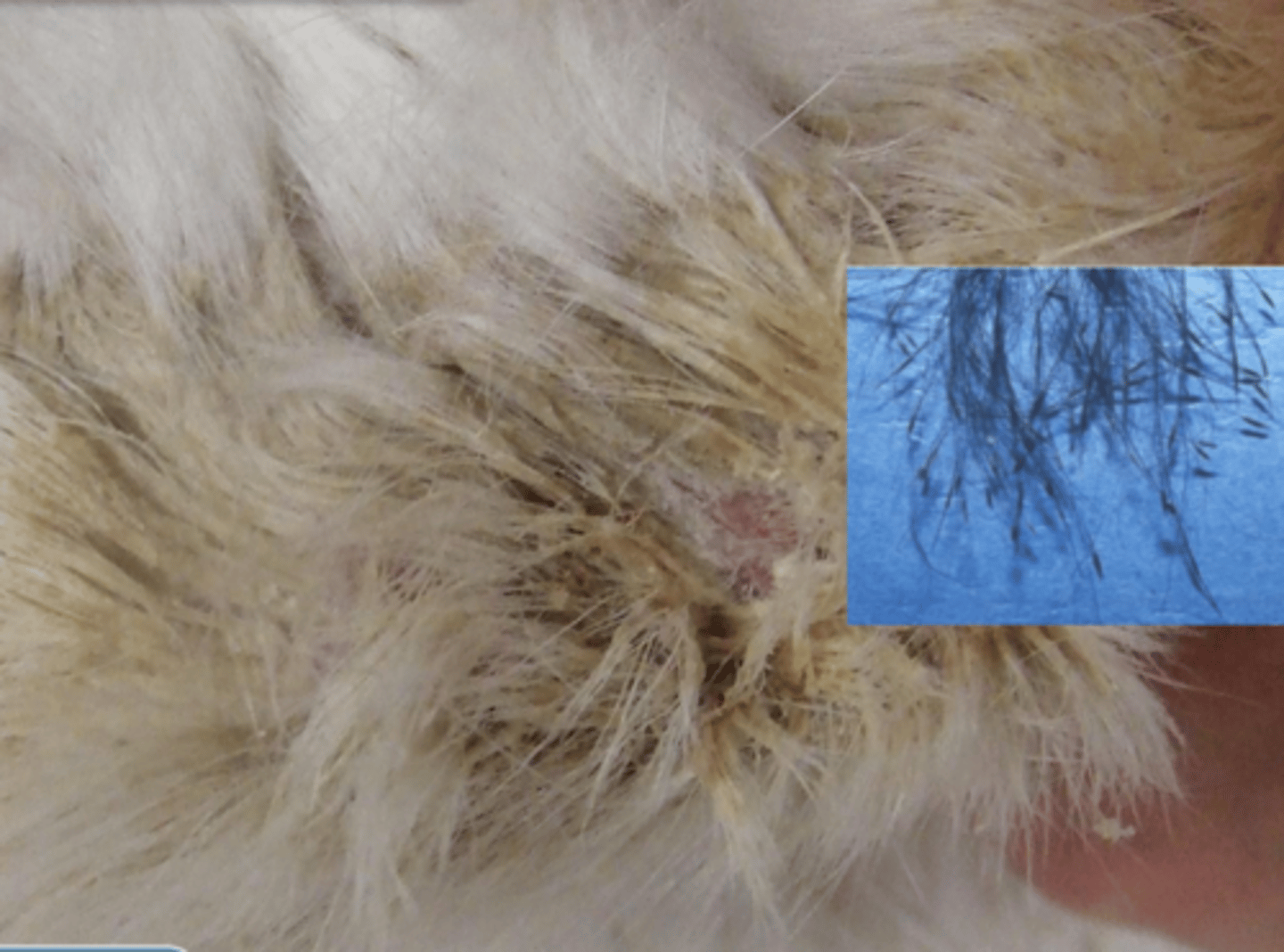 <p>What lesion is this? Is it primary or secondary?</p>