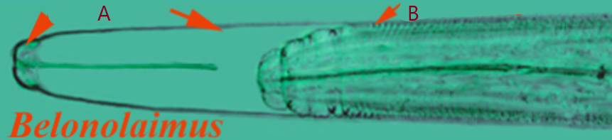 <p>What is happening in this image? What is structure A and what is structure B?</p>