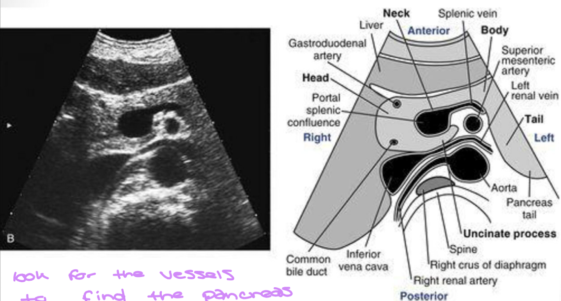 <p>Look over this image</p>