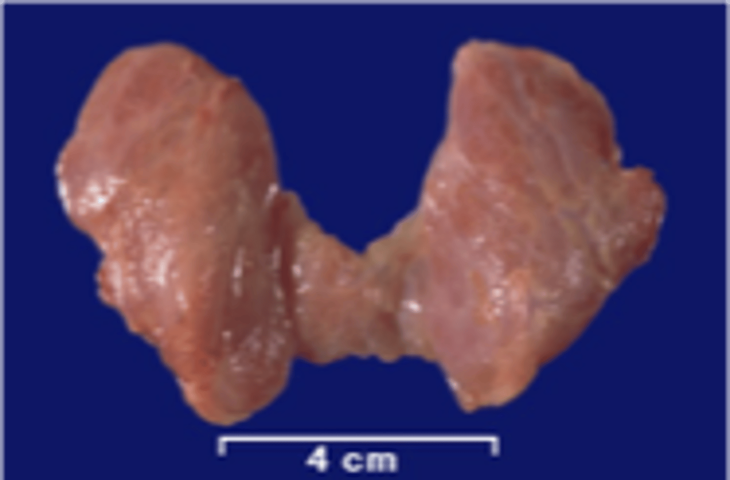 <p>Identify the structure</p>