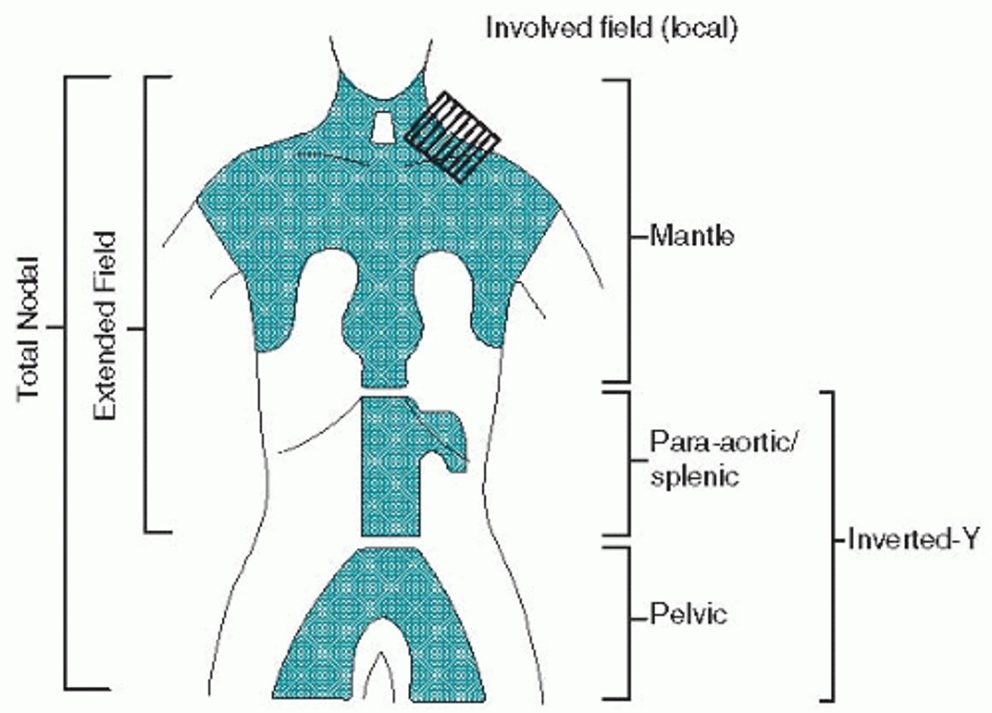 <p>Pelvis and para-aortic</p>