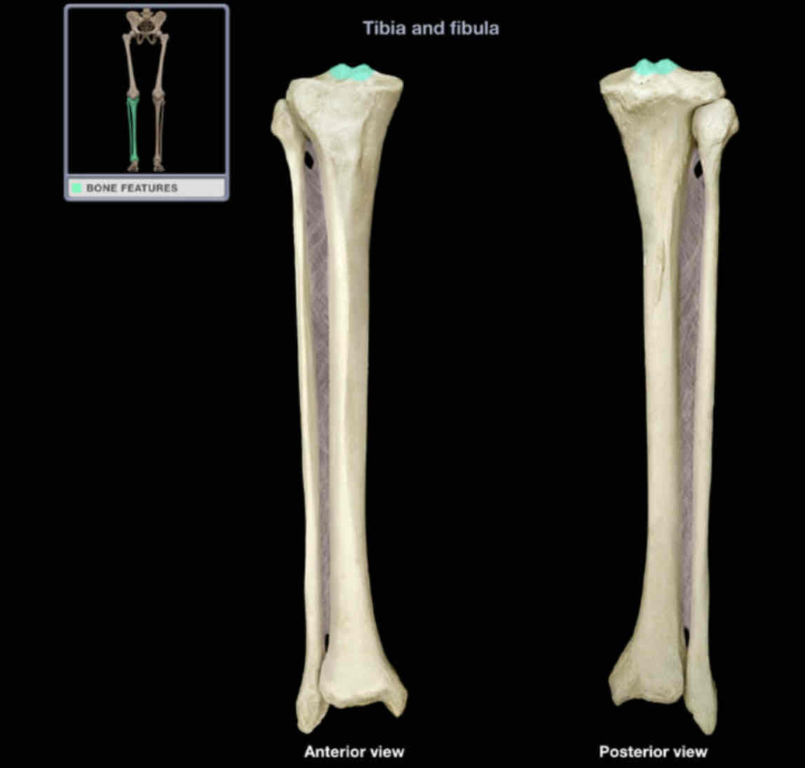 <p>Intercondylar eminence</p>