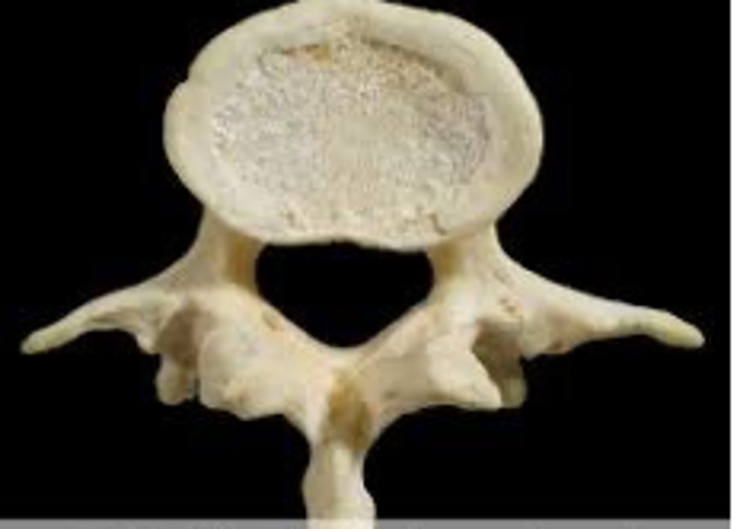 <p>-wings points towards the middle/slightly down</p>