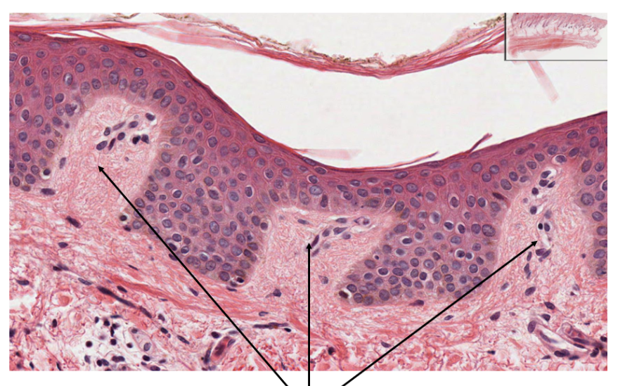 <p>the arrows point to</p>