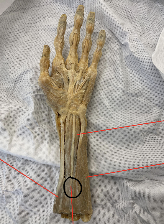 <p>identify + state origin, insertion, action, innervation of marked structure</p>