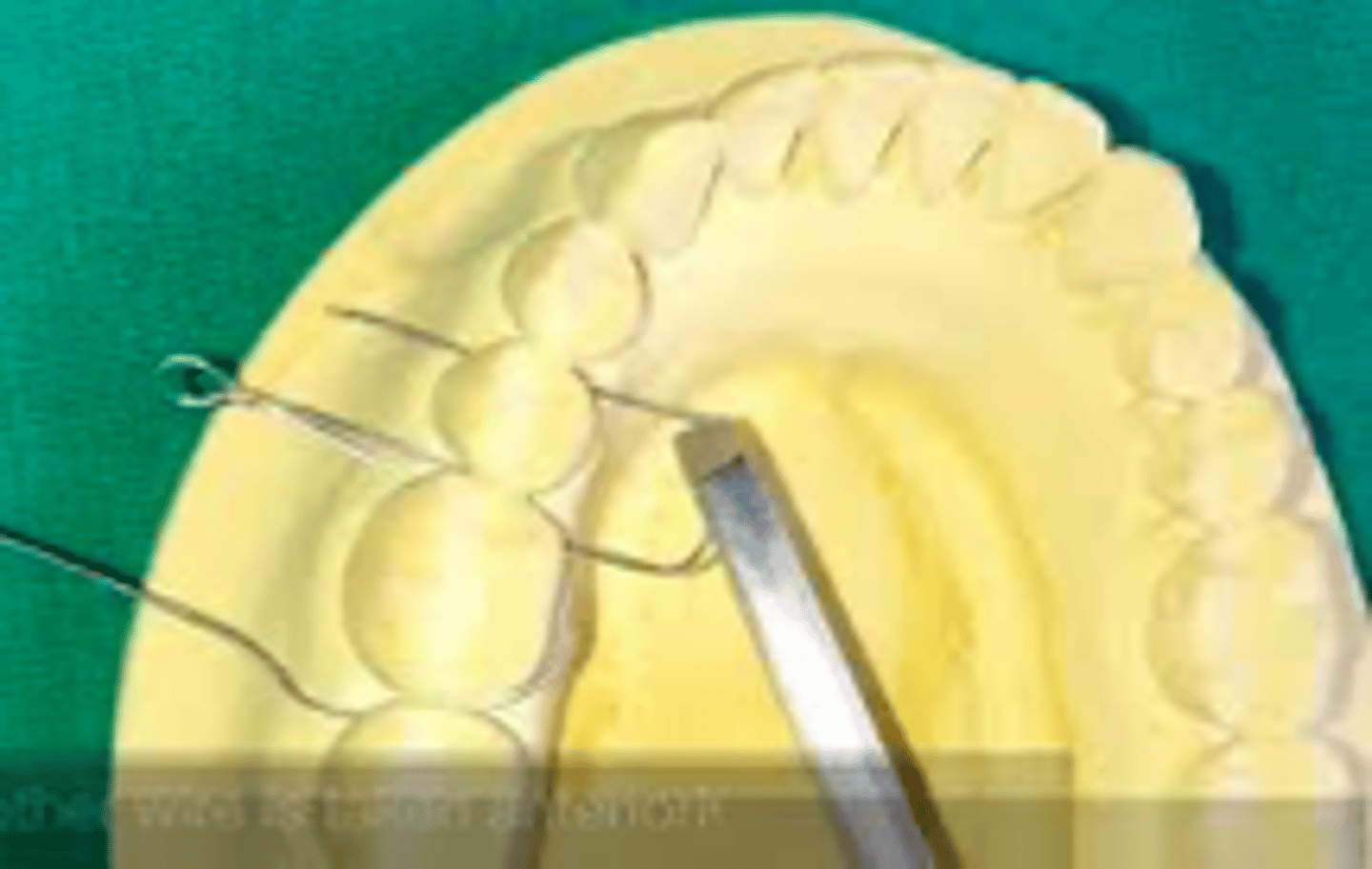 <p>ID the MMF device:</p>