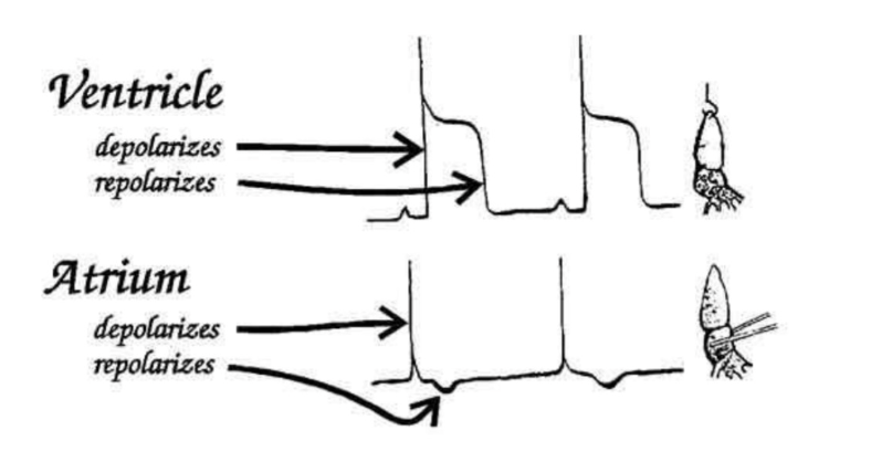 <ul><li><p>largest deflection→ electrical activity of <strong>atria</strong></p></li><li><p>compare events recorded from the pin electrode with probe</p></li></ul><p></p>