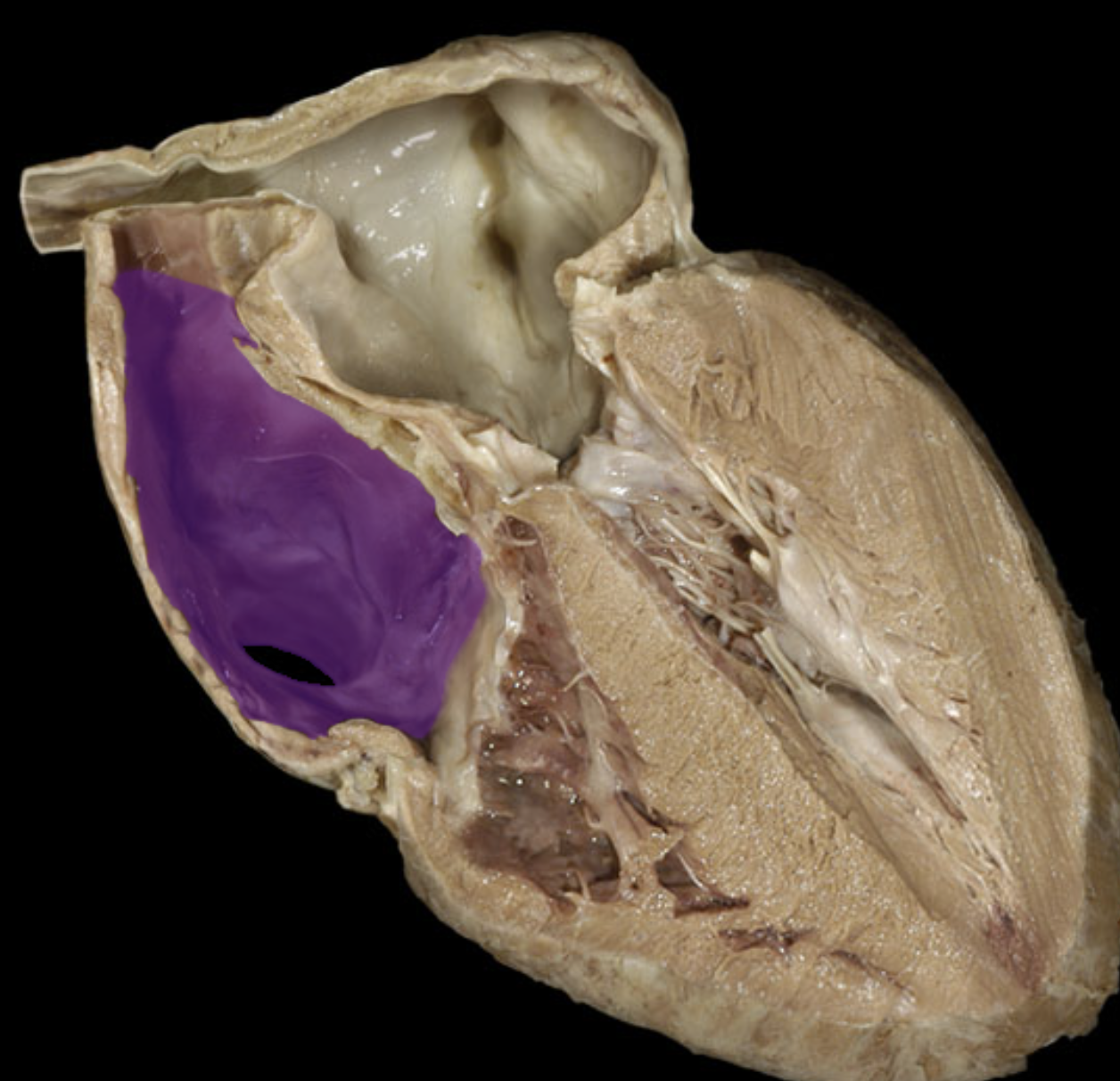 <p>Right atrium</p>