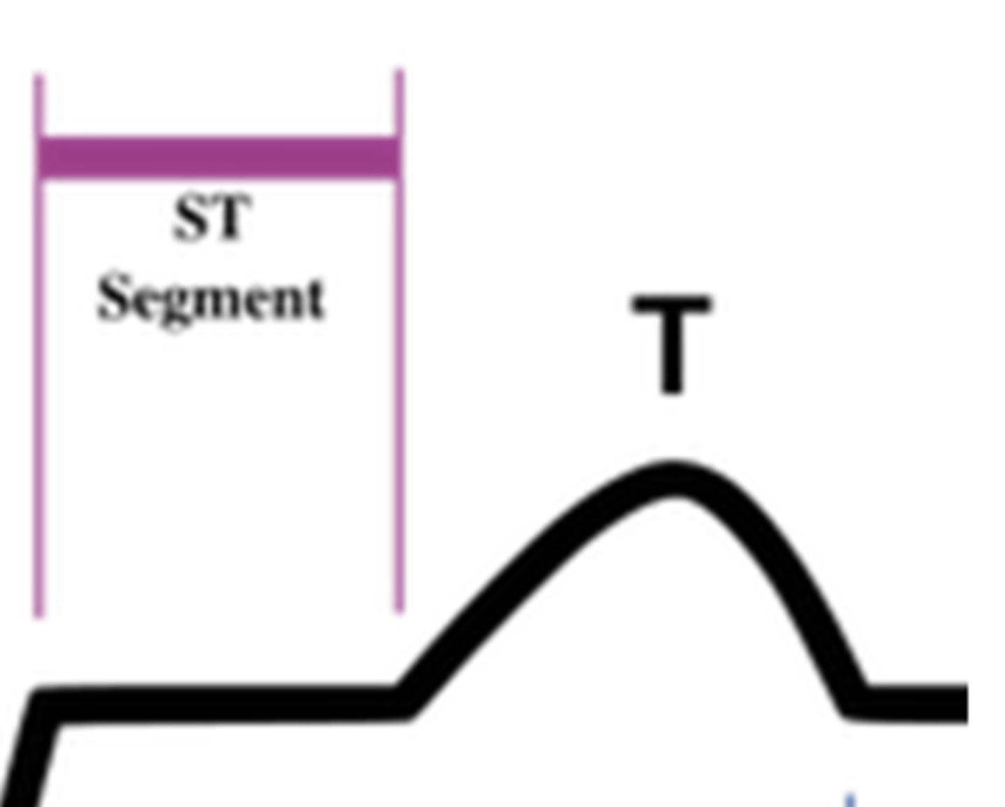 <p>plateau phase of the fast AP (between ventricular depolarization and repolarization)</p>