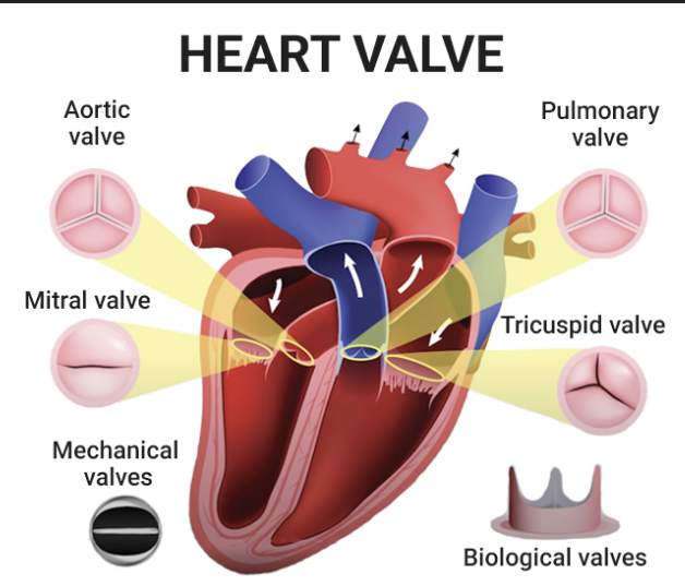 <p>Mitral (bicuspid) or tricuspid valve</p>
