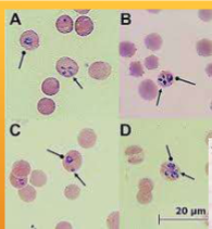 <p><span style="color: rgb(255, 255, 255);"><span>Theileria equi (formerly Babesia equi); Babesia caballi</span></span></p>