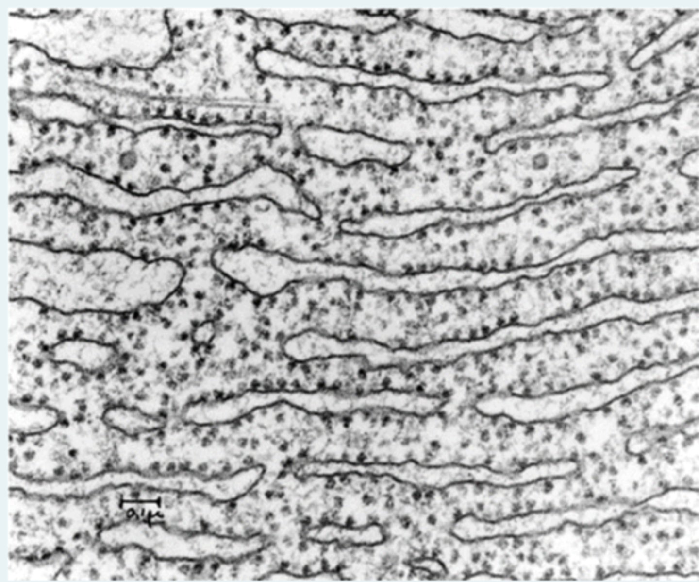 <p>Hvilket organel ses her</p>