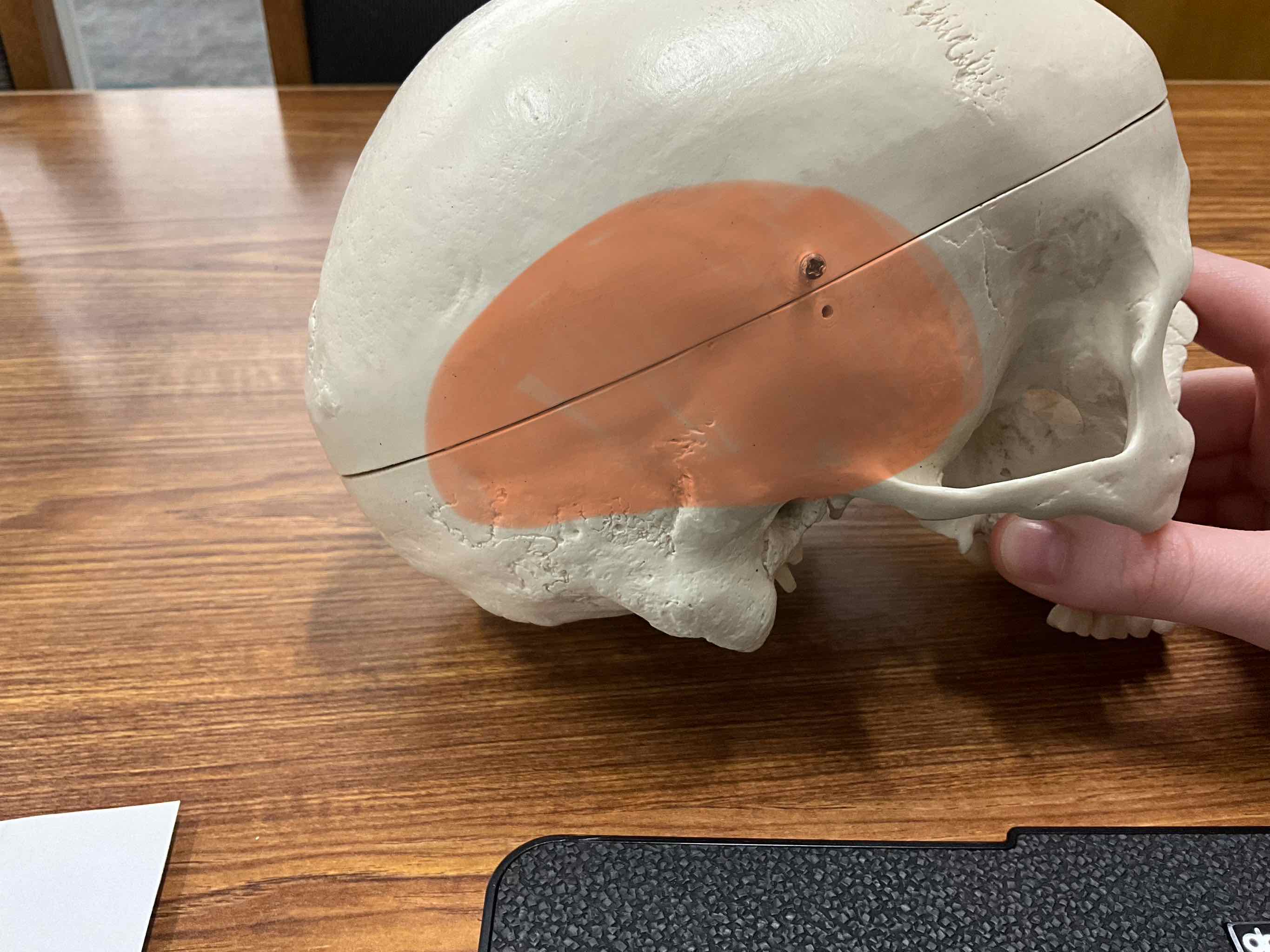 <p>Name the bone</p>