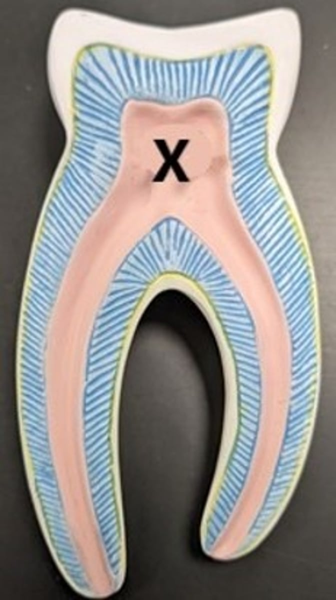 <p>ID the Internal Tooth Structure</p>