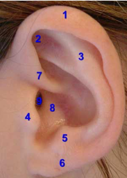 <p>external auditory canal</p>