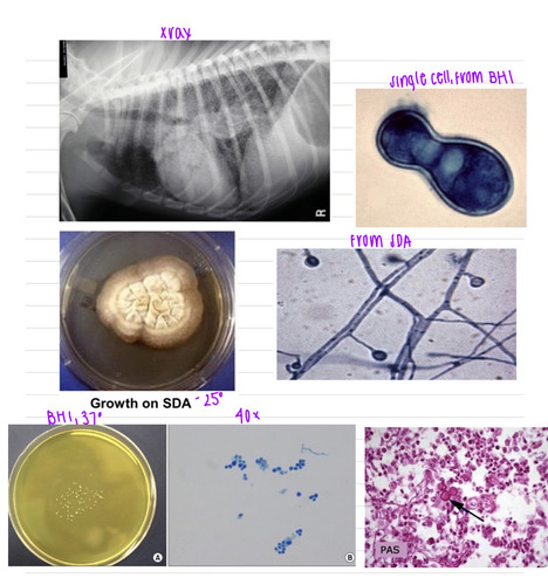 <p>a dog came into the vet because he was coughing, having trouble breathing, and could not go on runs with his owner anymore, which was unusual. we take an Xray and isolate a sample on BHI at 37 degrees and on SDA at 37 degrees.</p><p>what sample should we take?</p><p>what is the diagnosis?</p>