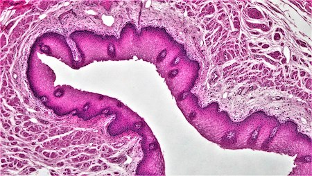 <p>Epithelial tissue: stratified squamous</p>