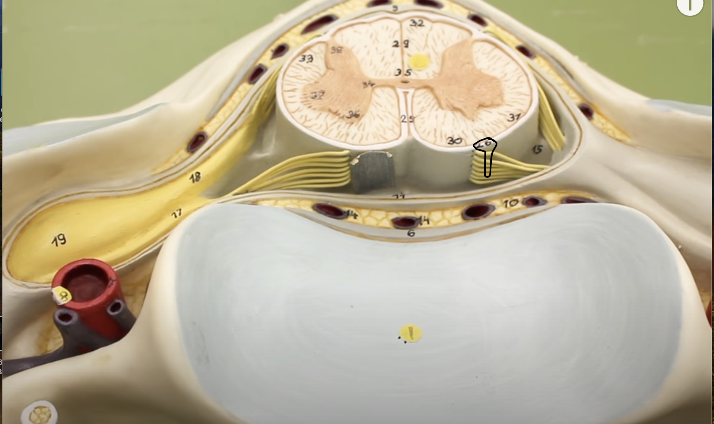 <p>what is this part of the vertebrae (of the spinal cord?)</p>