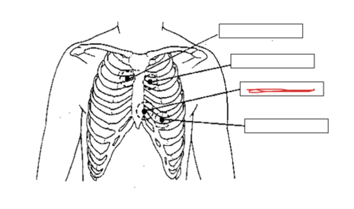 <p>in the fourth intercostal space (between ribs 4 &amp; 5) on the left sternal border</p>
