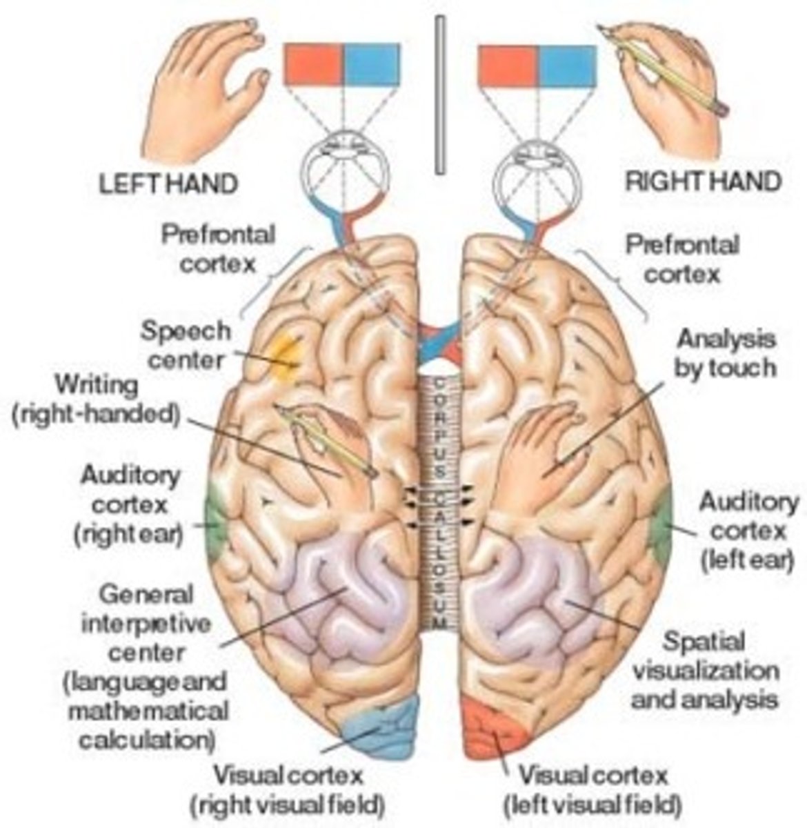 <p>study of patients with a severed corpus callosum; demonstrates right and left brain specialization; has been used to treat epilepsy</p>