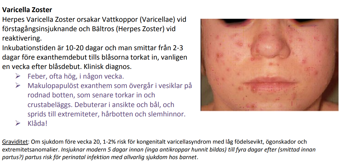 <p><strong>Varicella cerebellit </strong><span>.</span></p>