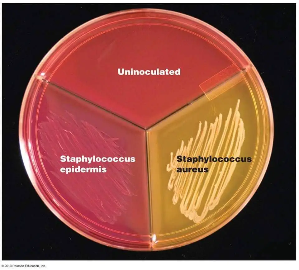 <p>What plate is this?</p>