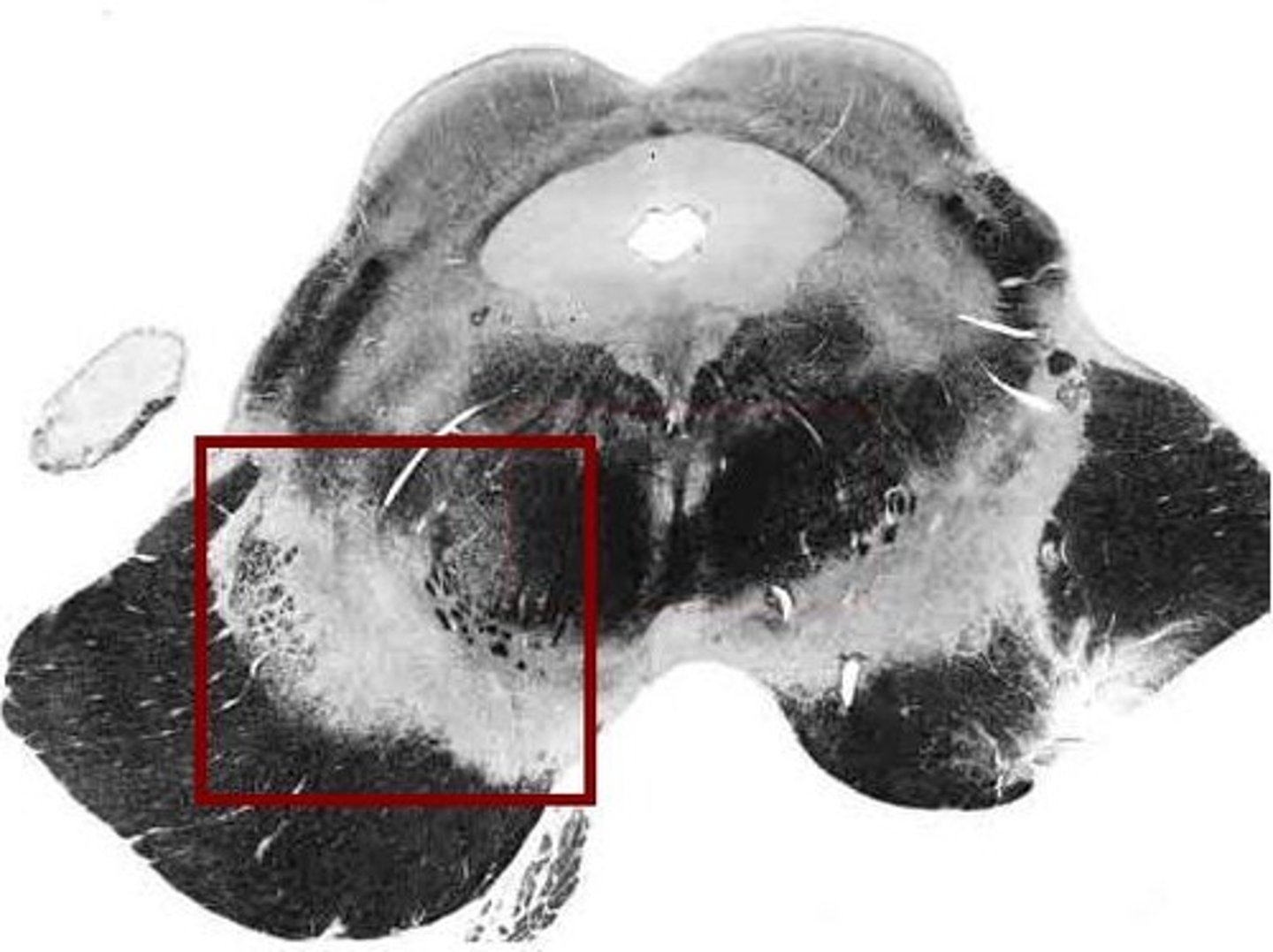 <p>-Motor center that relays inhibitory signals to thalamus and basal nuclei preventing unwanted body movement</p><p>-Black nucleus pigmented with melanin</p>