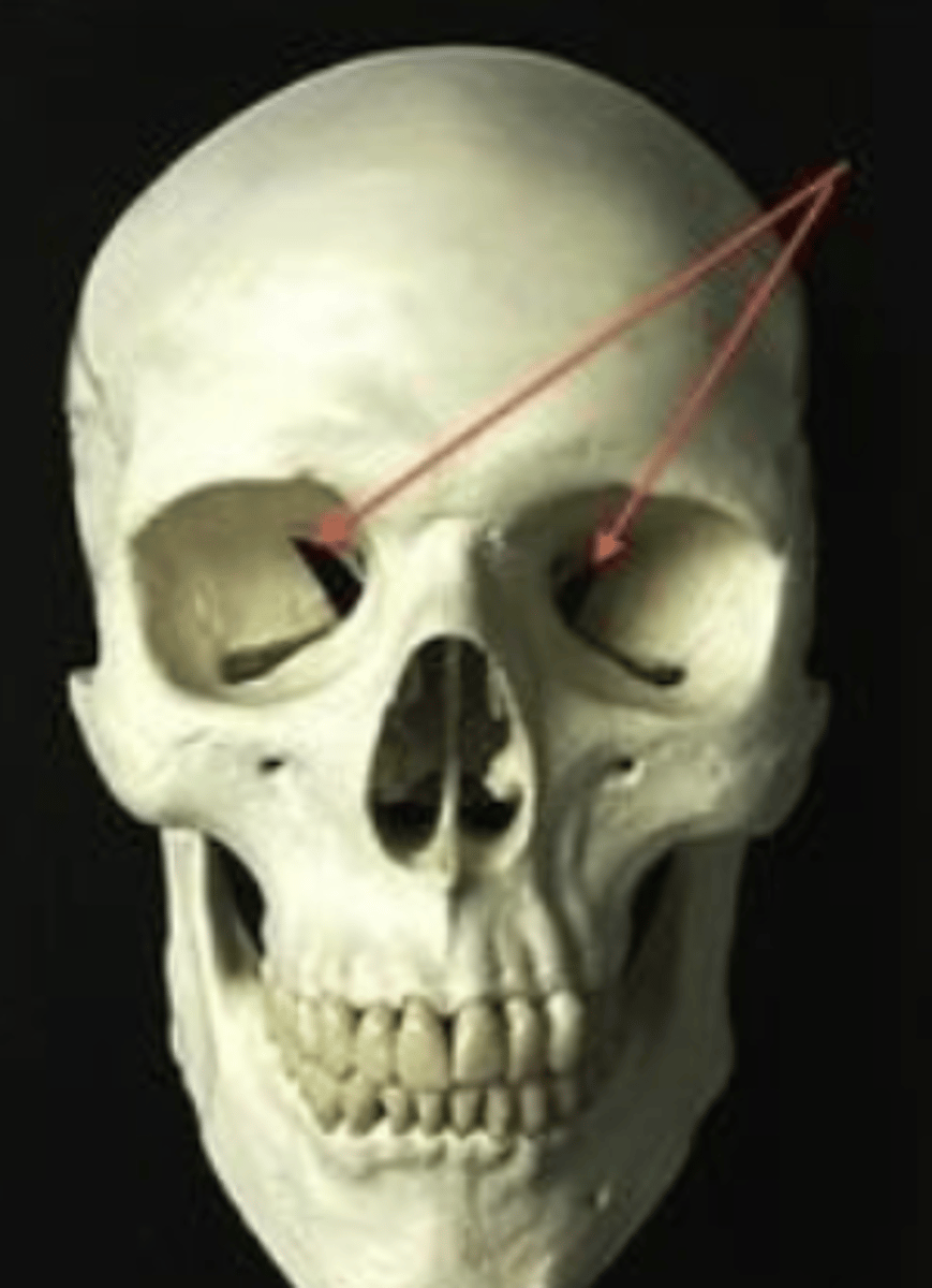 <p>superior orbital fissure</p>