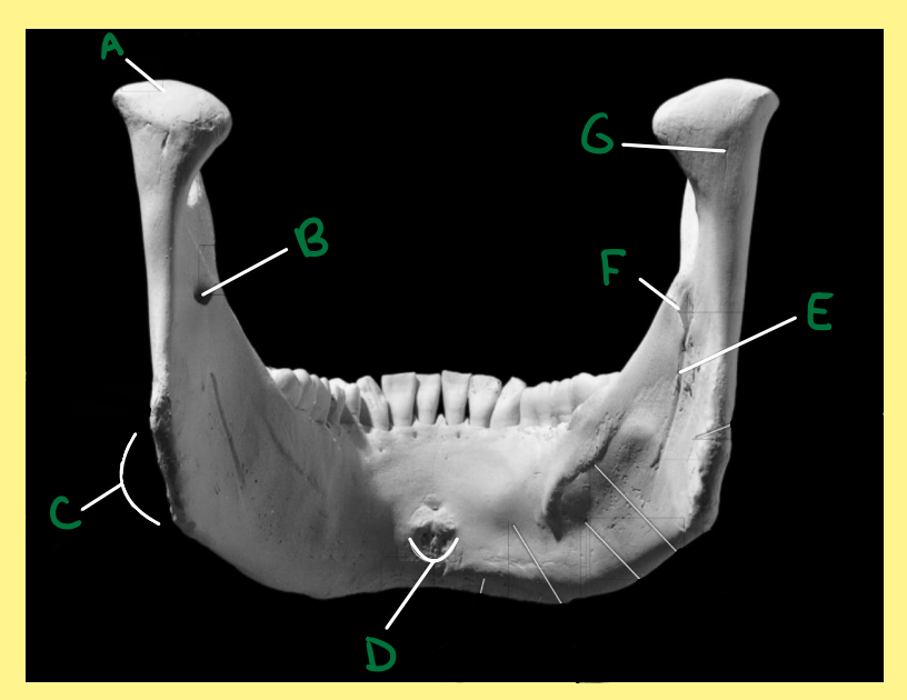<p><u>Name the following</u>:</p><ul><li><p>Bone?</p></li><li><p>Side?</p></li><li><p>View?</p></li><li><p>C?</p></li></ul><p></p>
