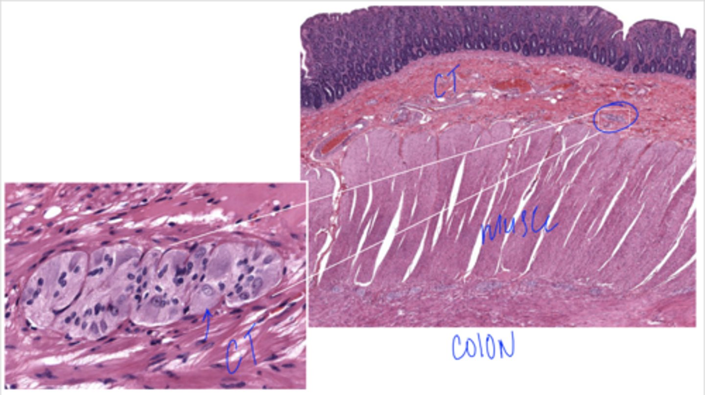 <p>Identify the organ of the PNS</p>