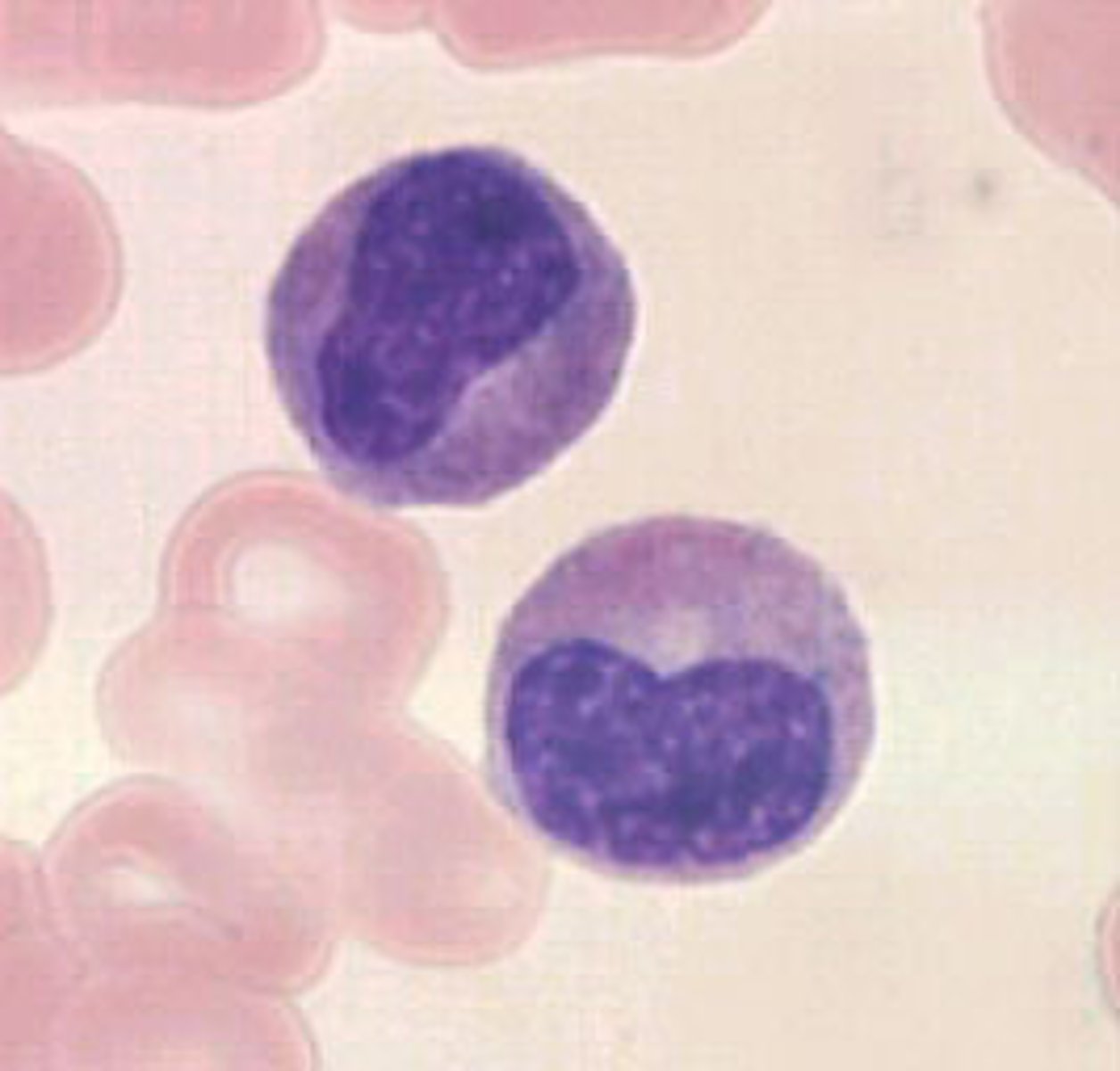 <p>- Indented <50% Nucleus</p><p>- Moderately clumped cytoplasm</p><p>- Pale pink to cream-colored cytoplasm</p><p>- Secondary granules</p><p>- 1.5:1 - 1:1 N:C Ratio</p>