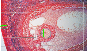term image