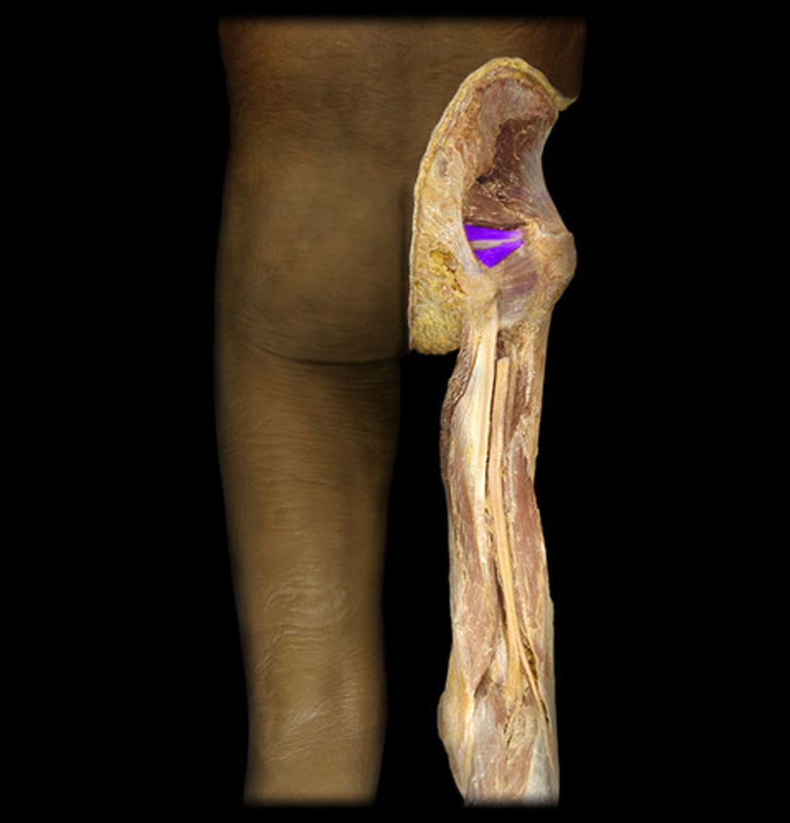 <p>Origin: ischial spine</p><p>Insertion: Greater trochanter</p>