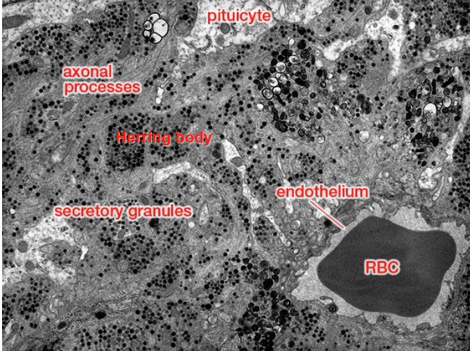 <p>Ultrastructure of the posterior pituitary (not a question) </p>