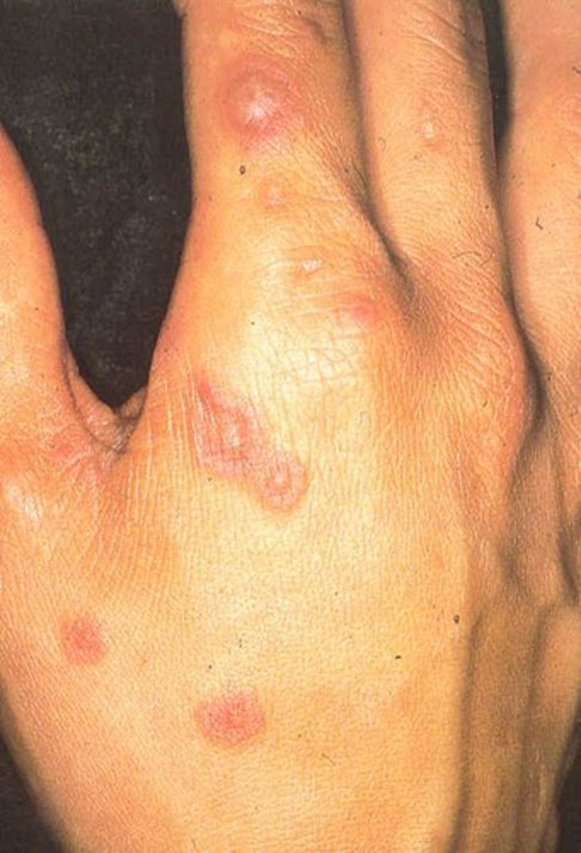 <p>Hint: target lesions</p>