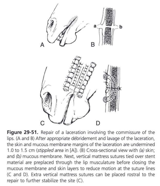 <ul><li><p><span>The lips are highly mobile tissues and close adherence of the mucosa and skin to underlying musculature results in excessive motion at sutures lines during prehension leading to a high incidence of dehiscence</span></p></li><li><p><span>To reduce motion on the suture lines, margins of the skin and oral mucosa are sharply undermined for 1-1.5 cm from the edges of the wound</span></p></li><li><p><span>Vertical mattress 0-1 nonabsorbable sutures are subsequently preplaced from the extraoral side through the lip musculature and tied over quills of soft rubber tubing</span></p></li><li><p><span>Mucous membrane is closed with simple continuous or interrupted 2-0 monofilament absorbable suture</span></p></li><li><p><span>Skin is apposed with simple interrupted or vertical mattress 2-0 to 0 nonabsorbable monofilament sutures</span></p></li><li><p><span>At the mucocutaneous junction, a vertical mattress pattern is recommended for precise apposition</span></p></li><li><p><span>When repairing laceration involving the commissure of the lips, additional vertical mattress tension-relieving sutures are placed rostral to the primary repair for increased support in this highly mobile area</span></p></li><li><p><span>Most common postoperative complication is dehiscence of the repair</span></p></li></ul>
