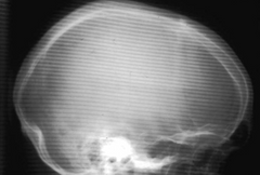 <p>What is the problem with this x–ray?</p>
